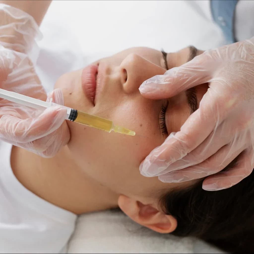 Fine injection being given to the upper face